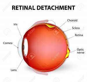 Retinal Detachment- Retina Ophthalmology Frederick MD