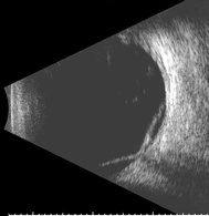 Ultrasonography